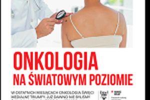 Onkologia na światowym poziomie